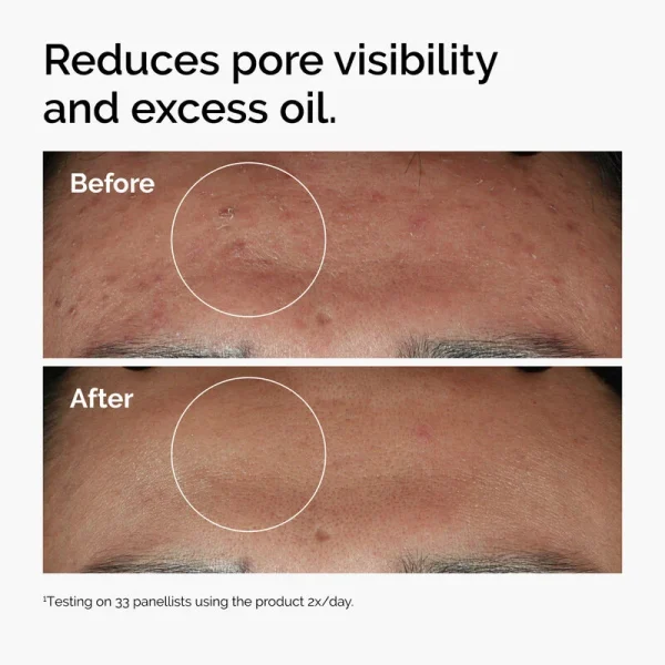The Ordinary Niacinamide 10% + Zinc 1% – 30ml - Image 3